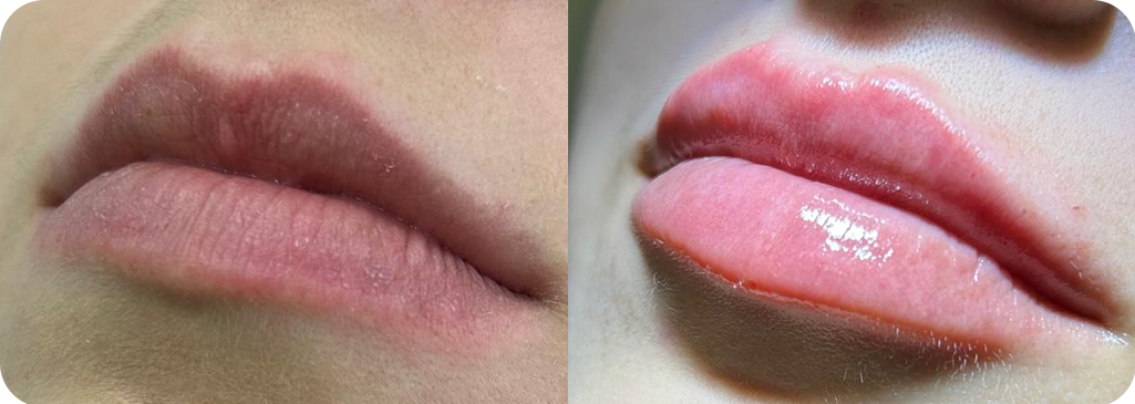 07.png